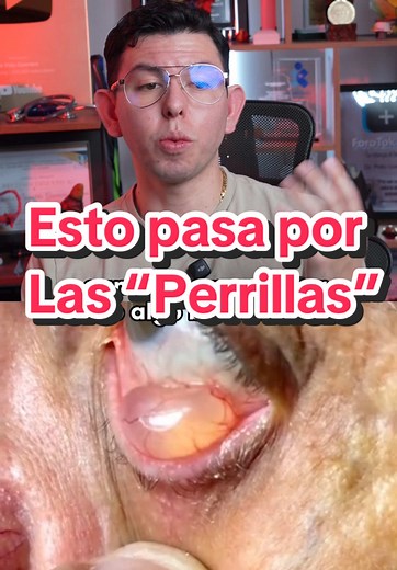 Cómo tratar un orzuelo en el ojo eficazmente
