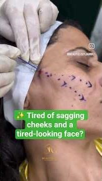 ✨ Cog thread face lift?