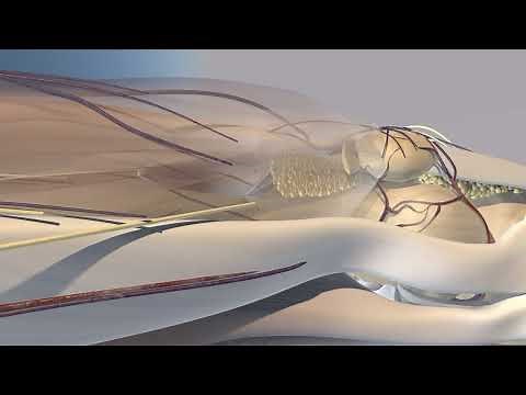 Knee Injection Suprapatellar Approach