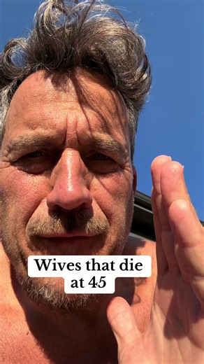 Flapping hands, or asterixis, can manifest in a 45-year-old woman with alcohol-related cirrhosis due to hepatic encephalopathy. As the liver fails, toxins accumulate, affecting brain function. The involuntary movements symbolize the body's struggle against the effects of liver damage. Addressing the underlying cirrhosis through medical intervention is crucial, alongside support for her mental and physical health. My wife died at 45 years old of decompensated alcohol cirrhosis she had flapping ha