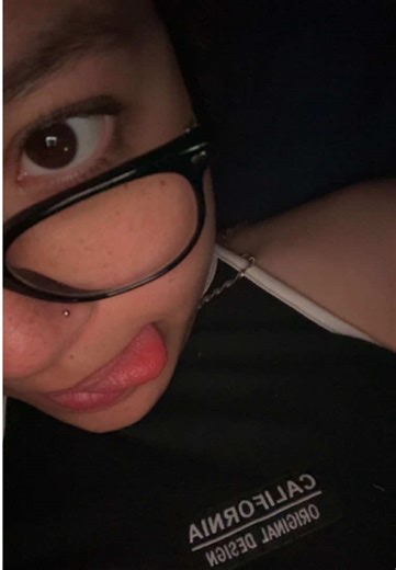 Testing Lazy Eye Perception: My Experience
