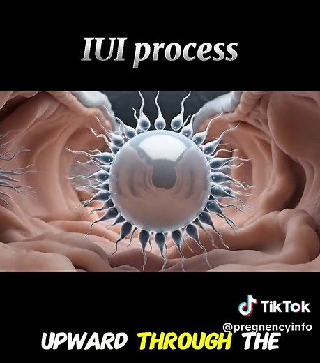 IUI Process Explained | How Intrauterine Insemination Works Step by Step #IUI #IUIProcess #IntrauterineInsemination #FertilityTreatment #FertilityJourney