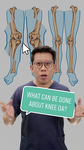 Managing Knee Osteoarthritis Symptoms with Physiotherapy
