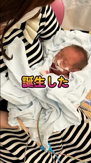 【双子の出産】妊娠～出産､退院 birth of twins #Shorts