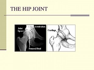 THE HIP JOINT - SlideServe