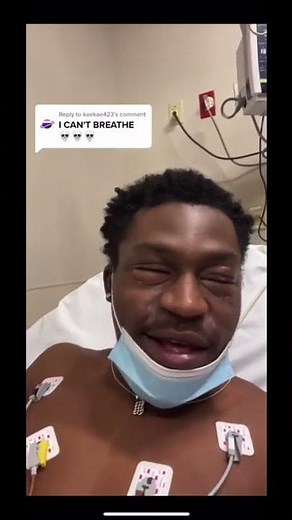 Severe Reaction To A NUT ALLERGY.