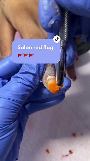 Identifying MMA Nails: Salon Red Flags and Unsafe Practices