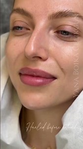 Perfect Permanent Lip Makeup Transformation 🔥 | Professional PMU Technique by @yana.pmu