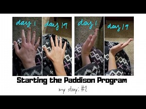 Starting the Paddison Program