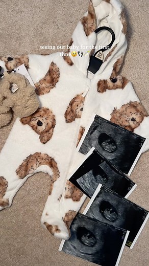 Shannon Williams | First time seeing our lil baby🥹 we had an early reassurance scan with @firstencountersultrasound . Its an abdominal scan designed to check... | Instagram