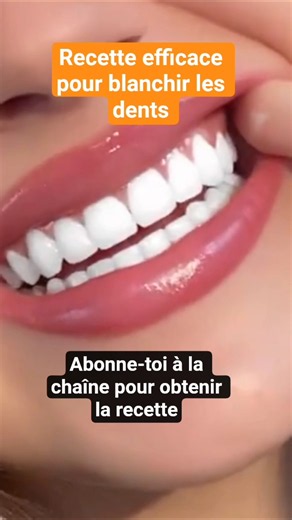 la recette efficace pour blanchir les dents #pourtoi #beauty #viral