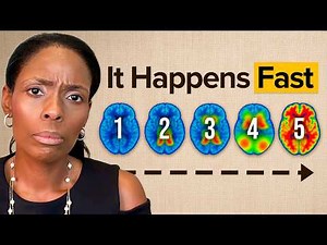 Alzheimer's Dementia Progression: What Happens Next?