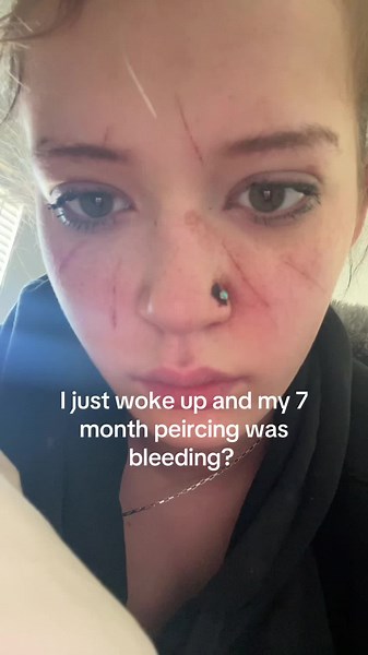 Piercing Bleeding After 7 Months? Why It Happens