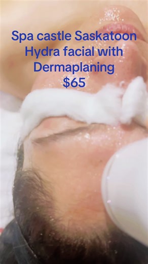 Spa castle Saskatoon Hydrafacial with Dermaplaning
