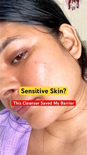 Moiz 👉Gentle Cleanser for Damaged Skin Barrier | Honest Review #skincare #barrierrepair #trending