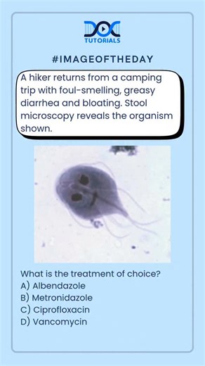 DocTutorials - NEET PG on Instagram: "#imageoftheday 👉 A hiker returns from a camping trip with foul-smelling, greasy diarrhea and bloating. Stool microscopy reveals the organism shown. What is the treatment of choice? A) Albendazole B) Metronidazole C) Ciprofloxacin D) Vancomycin 💬 Drop your Answers in Comments👇 #neetpg #fmge #inicet #giardialamblia #giardiasis #parasitology #microbiology #medicalmcq #spotterquestion #examoriented #mbbs #medicalstudents #doctutorials #usmle #plab"