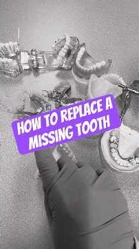 How to replace a missing tooth. #dentist #dentalprosthesis #dentalassistant #teeth