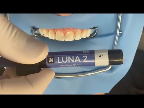 Utilização clínica da Resina Luna 2 e Luna Flow | Prof. Renato Voss Rosa
