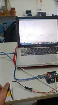 Pulse Sensor interfaced with Arduino