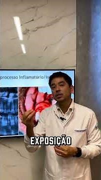 Extração do Siso: Dúvidas Frequentes Que Você Precisa Saber!