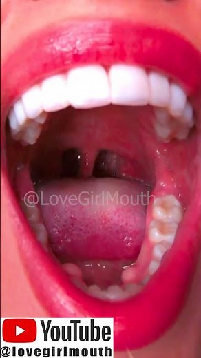 Perfect teeth from dream girl, teeth, molars, tongue and palate, mouth tour #mouthtour #teeh