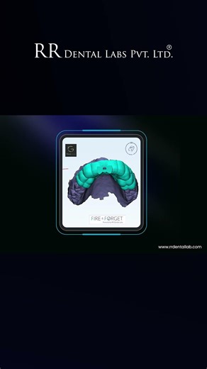 Its RR Dental lab- best dental lab in India