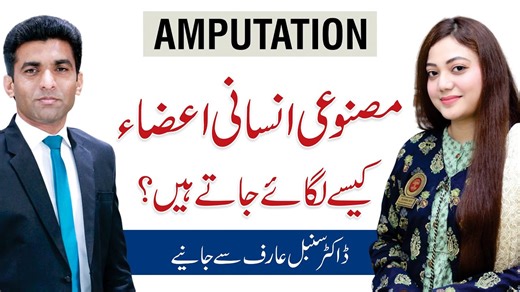 How Artificial Arms & Legs Work After Amputation - Dr Sumble Arif with Shams Ul Haq | Qasim Ali Shah Foundation