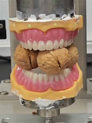 Myy dental lab Comprehensive dental lab services, including crowns, bridges (Zirconia, E-max, PFMs), implants, dentures (full/partial), and orthodontics. Technology: Uses modern equipment and techniques, accepting digital files and traditional impressions. #dentallab #dental #zirconia #germanydentalclinic #dentallaboratory #dentist #dentures #义齿工厂 #Aligners #假牙 #假牙厂家 #义齿 #zircon