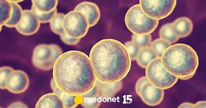 Jak leczyć moraxella catarrhalis?