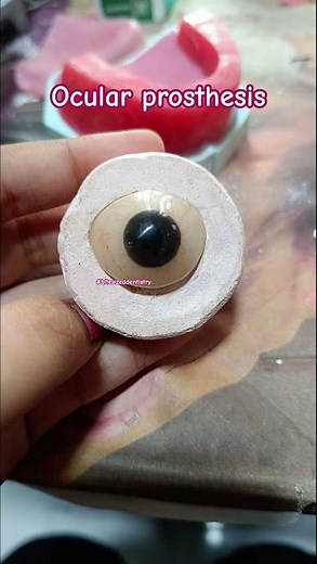 Eye(ocular) prosthesis#eye#prosthetics#prostheticeye#bds#mds#oculus#believeinyourself#prosthodontics