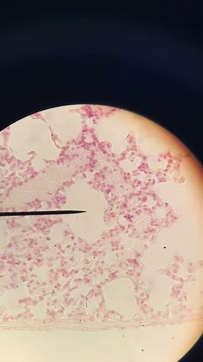 Microscope slides of a Lung#2. Anatomy and physiology I