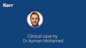 Kerr Harmonize Direct Veneer Application: Step-by-Step Dental Composite Procedure