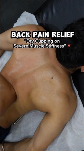 “Back Pain FIXED in Minutes with Cupping!”