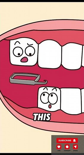 How Do Dentists Fix an Underbite? The Transformation Will Surprise You!