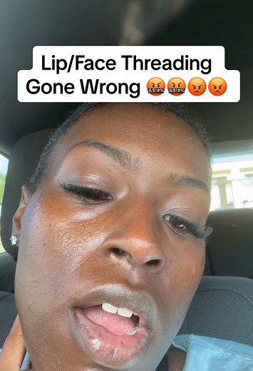 Lip Threading Gone Wrong: My Terrifying Experience