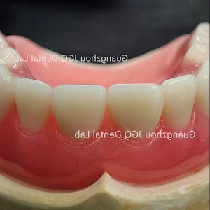 [Hot Item] Customized High Quality Complete Denture with Acrylic Dentures Restore The Normal Function and Appearance of Teeth