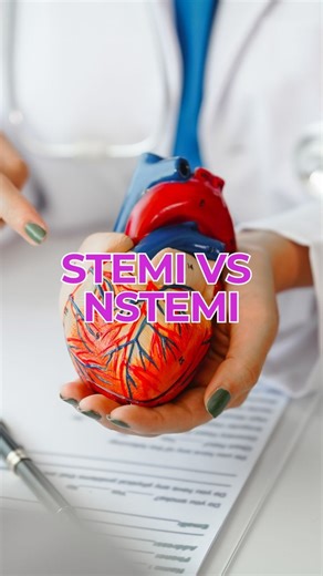 🫀 STEMI vs NSTEMI : quelle différence ? Deux types d’infarctus du myocarde… mais pas la même présentation ni la même urgence. 👉 STEMI (ST-Elevation MI) • Blocage complet d’une artère coronaire • Élévation du segment ST à l’ECG • Urgence absolue → reperfusion rapide (angioplastie ou thrombolyse) 👉 NSTEMI (Non-ST Elevation MI) • Blocage partiel d’une artère coronaire • Pas d’élévation du ST mais enzymes cardiaques élevées • Urgence aussi, mais prise en charge différente ⚠️ Dans les deux cas, c’