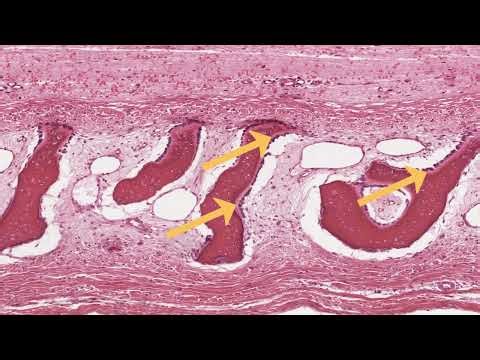 Intramembranous Ossification
