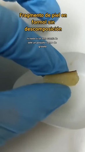 Cómo preservar cuerpos en formol: Técnicas y aplicaciones