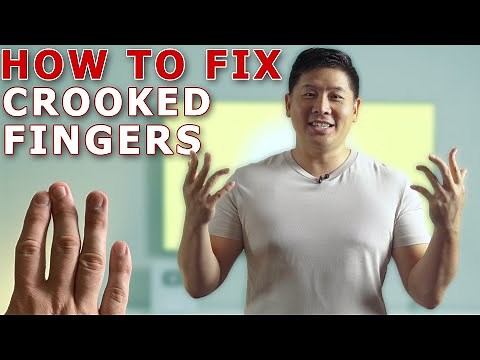 Straighten Your Crooked Fingers With This Simple Trick! | Finger Mobilization By Physical Therapist