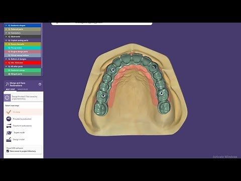 How to design screw retained implant/All on Four - Implant Bridge design with Exocad 3.0