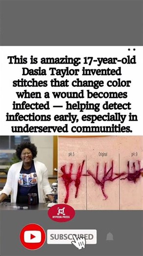 👩🔬🌈 17-Year-Old Invents Color-Changing Stitches To Detect Infection!#shorts