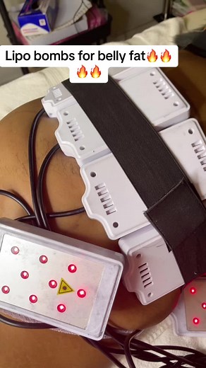 Lipo Devices for Body Contouring and Fat Reduction