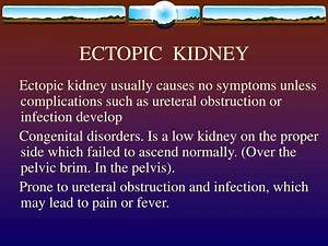 ECTOPIC KIDNEY - SlideServe