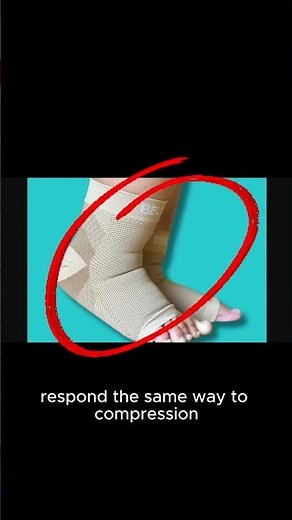 Why Compression Socks Don’t Work for All Ankle Swelling