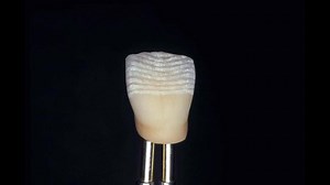 10sec step photos of Internal Live Stain Technique of Legend Mr. Aoshima more than 20years ago. It can still bring fresh impression, can't it?? | Noritake Dental International