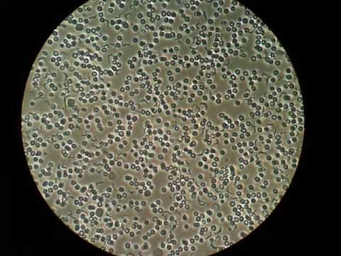 Trypanosoma brucei in blood (microscopy)