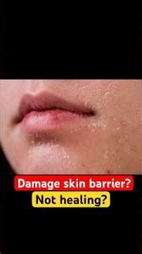 What is Damaged Skin Barrier? how to repair damaged skin barrier? Skin become sensitive #skinbarrier