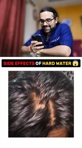 35K views · 84 reactions | SIDE EFFECTS OF HARD WATER #HardWaterProblems #SkinCareTips | Dr Ankur Gautam | Facebook