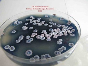 Streptomyces coelicolor - Alchetron, the free social encyclopedia